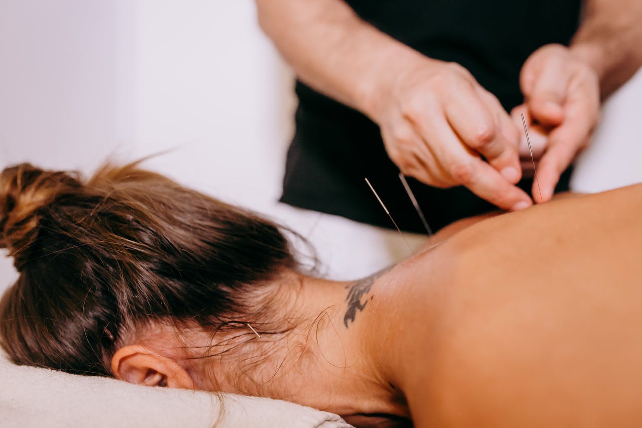 health benefits of acupuncture