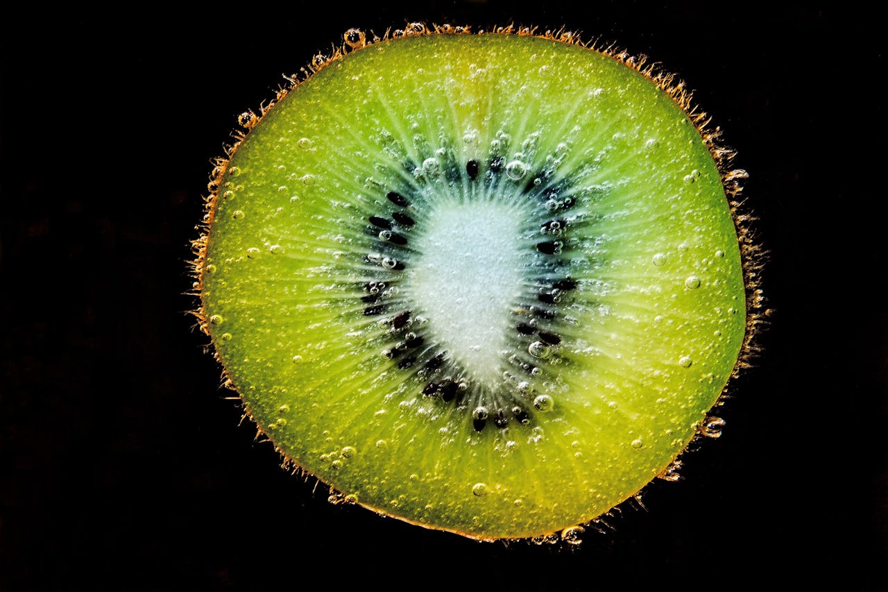 Help Your Body With Kiwi: Health Benefits and Nutrients